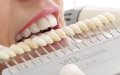 Ästethische Funktionelle Zahnheilkunde