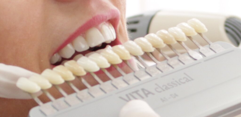 Ästethische Funktionelle Zahnheilkunde